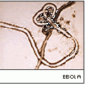 EbolaVMicro.gif